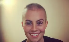 Лысые девушки запустили в Сети вдохновляющий флешмоб 7