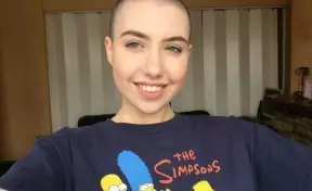 Лысые девушки запустили в Сети вдохновляющий флешмоб 9