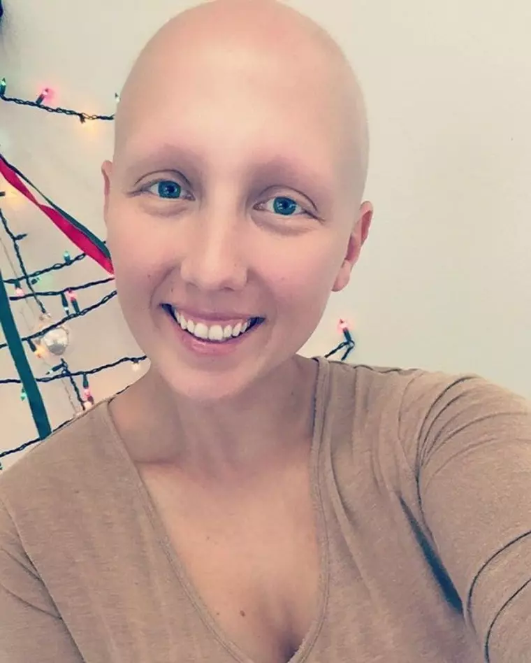 Лысые девушки запустили в Сети вдохновляющий флешмоб 11