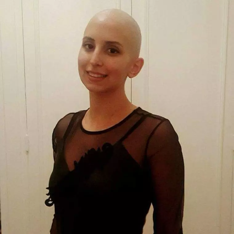 Лысые девушки запустили в Сети вдохновляющий флешмоб 17