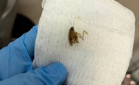 В Подмосковье врачи достали из уха пациентки живого таракана 