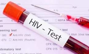 Быстро и бесплатно: кемеровчане смогут пройти экспресс-проверку на ВИЧ