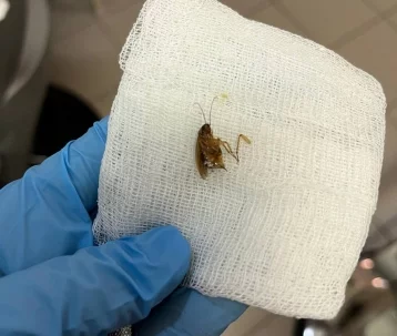Фото: В Подмосковье врачи достали из уха пациентки живого таракана  1