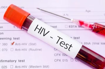Фото: Быстро и бесплатно: кемеровчане смогут пройти экспресс-проверку на ВИЧ 1