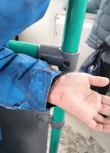 Фото: В Кемерове ребёнок поранился о сиденье старого троллейбуса 1