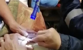 В Кемерове спасатели освободили опухший палец женщины, которая не хотела снимать кольцо