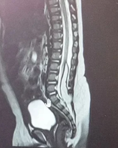 Фото: <a href=https://t.me/minzdravkuzbassanews/11128>минздрав Кузбасса</a> / Телеграм