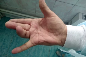 Фото: Хирург из Санкт-Петербурга во время поездки в Кемерово спас руки известного детского врача 2