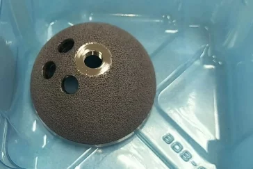 Фото: В Новокузнецке врачи поставили на ноги пациента, который почти не мог ходить 2