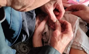 В Кузбассе спасатели освободили палец 5-летней девочки от кольца
