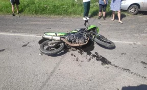 В Кузбассе двое детей на мотоцикле пострадали при столкновении с машиной 