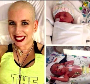 Фото: Дважды победившая рак женщина умерла сразу после рождения близнецов 1