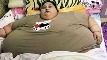 Фото: Самая толстая женщина в мире умерла после операции по снижению веса 1