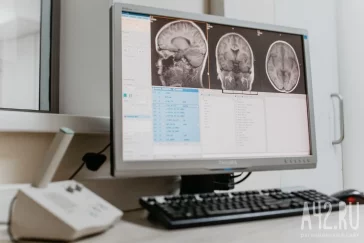 Фото: «В головном мозге увидели опухоль»: почему регулярно делать МРТ — это правильно 2