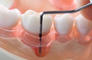 Фото: Как снизить риск инсульта: рассказывает стоматолог 12