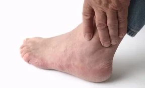 Житель Франции обнаружил фотографию своей ампутированной ноги на пачке сигарет