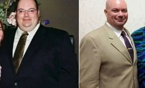 Мужчина после развода похудел на 112 килограммов без диеты