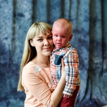 Фото: Кемеровчане собрали около миллиона на лечение ребёнка с «ошпаренной» кожей 1