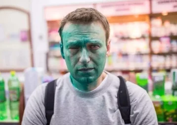 Фото: СМИ: по факту нападения на Навального возбуждено уголовное дело 1