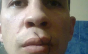 Российский заключённый зашил себе рот из-за несостоявшегося свидания