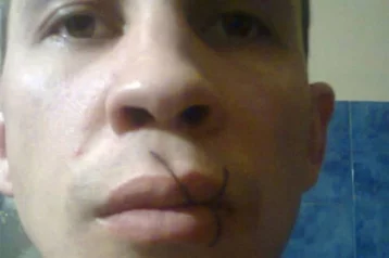 Фото: Российский заключённый зашил себе рот из-за несостоявшегося свидания 1