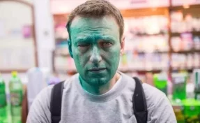 СМИ: по факту нападения на Навального возбуждено уголовное дело