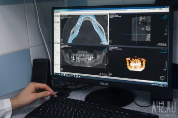 Фото: Восстановить утраченный зуб без мучений: стоматолог «Улыбки» рассказал об имплантации 9