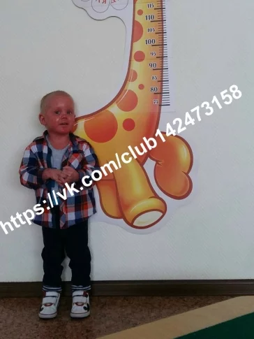 Фото: Кемеровчан просят помочь двухлетнему мальчику с «ошпаренной» кожей  3