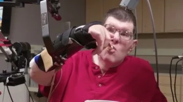Фото: Врачи впервые помогли парализованному человеку двигать рукой силой мысли 1