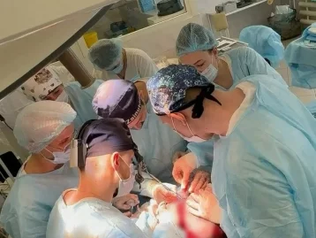 Фото: Кузбасские врачи удалили с лица девушки редкую опухоль весом 5 кг 1