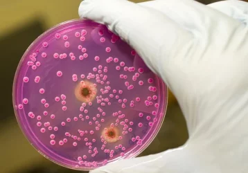 Фото: Сибирские учёные придумали новый способ борьбы с грибком 1