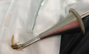 Жаловался на боли: кемеровчанин пришёл в больницу с насекомым в ухе