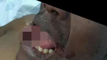 Фото: В ЮАР женщина‐врач откусила язык насильнику 1
