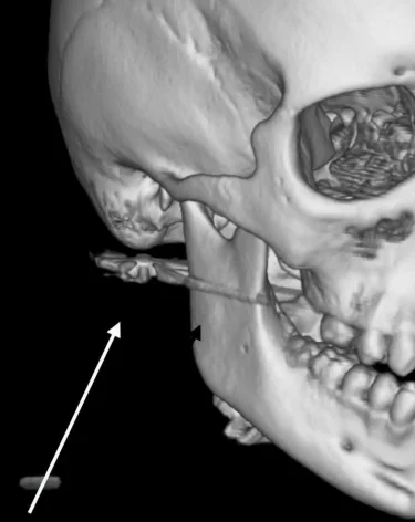 Фото: <a href=https://t.me/kkb2prim/6886>Краевая клиническая больница № 2</a>/Telegram