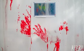 Кузбассовцы сообщили о жестоком избиении девочки-инвалида подростками