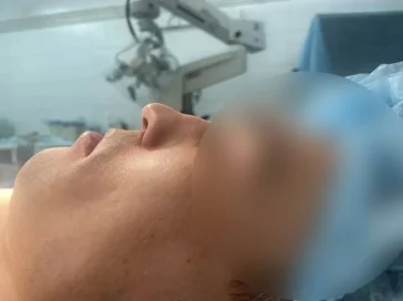Нос пациента до ... 