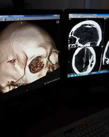 Фото: <a href=https://vk.com/wall-211372155_3412>КГБУЗ ККБСМП Барнаул</a>/ВКонтакте