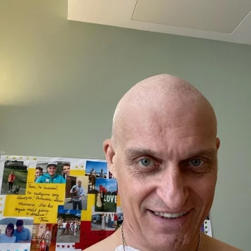 Фото: Уроженец Кузбасса Олег Тиньков рассказал о потере волос из-за химиотерапии 1