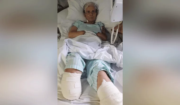 Фото: Женщина из-за камней в почках лишилась рук и ног  2