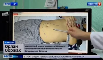 Фото: В Кемерове врачи удалили девушке огромную селезёнку 1