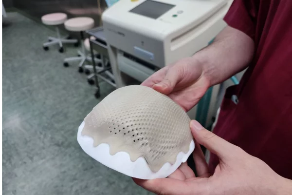 В Кузбассе пациенту с травмой головы изготовили фрагмент черепа на 3D-принтере