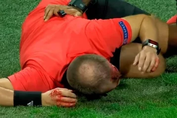 Фото: Фанат во время матча «Штурм» — АЕК разбил арбитру голову 1