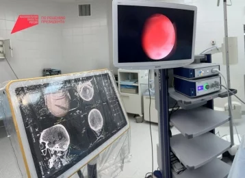 Фото: Кузбасские хирурги спасли мужчину с острым кровоизлиянием в мозг 1