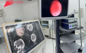 Кузбасские хирурги спасли мужчину с острым кровоизлиянием в мозг