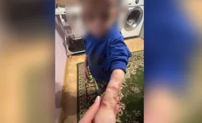 В Якутии у матери изъяли 6-летнего избитого мальчика весом 13 килограммов