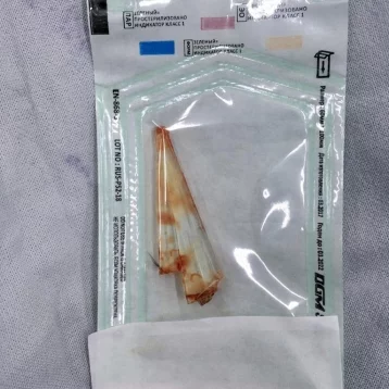 Фото: В Кемерове врачи достали часть ножа из глаза пациента 4