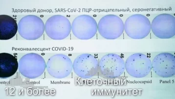 Фото: «Это сенсация»: уроженка Кемерова Елена Малышева рассказала о клеточном тесте на коронавирус 1