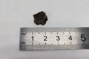 Фото: Кузбасские нейрохирурги извлекли осколок из спины бойца СВО 1