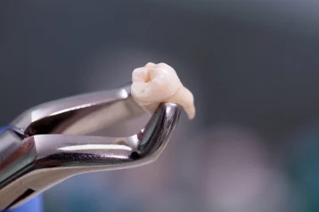 Фото: Как в страшном сне: сибиряк пытался вылечить больной зуб и впал в кому 1