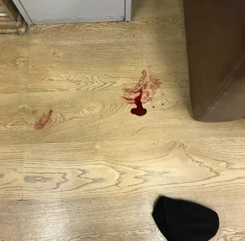 Фото: Вооружённый ножом мужчина порезал ведущую в редакции «Эха Москвы» 1